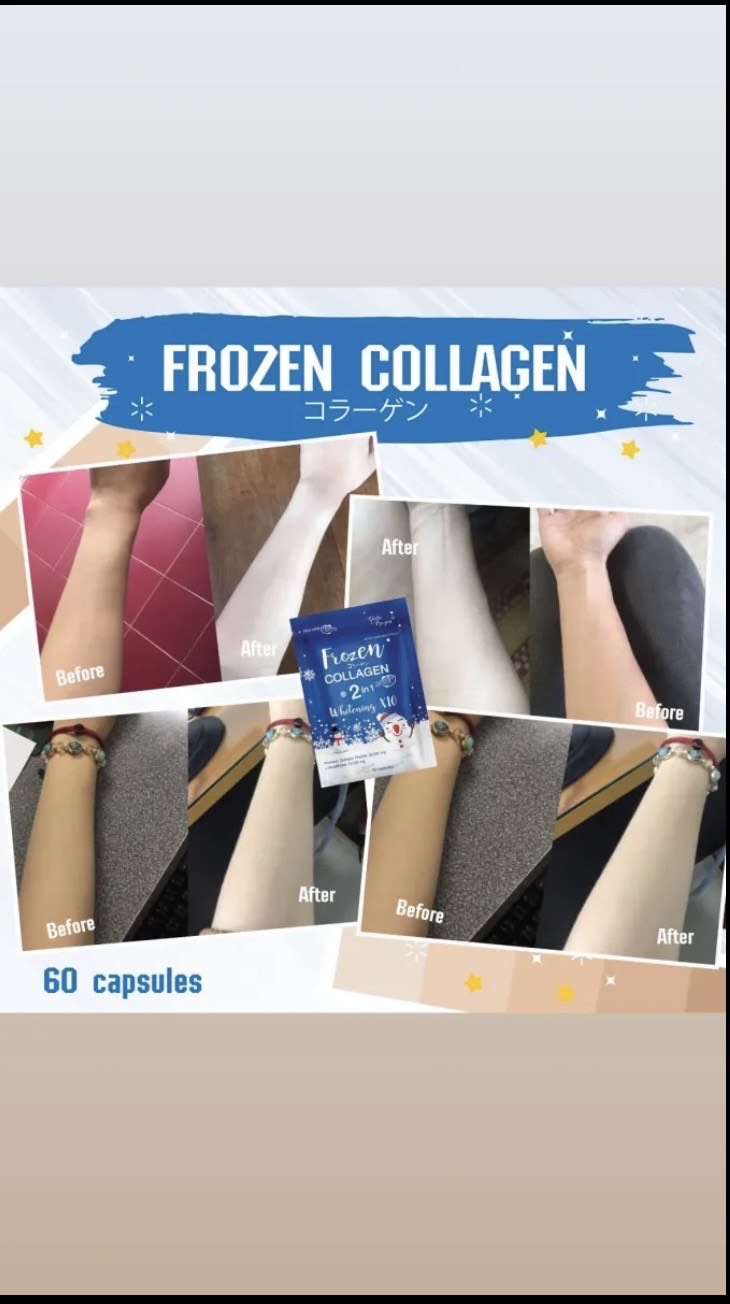Glowsy skin Frozen Collagen Whitening Capsules. 100% natural and herbal!